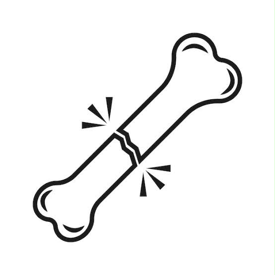 Tratamento de Fraturas