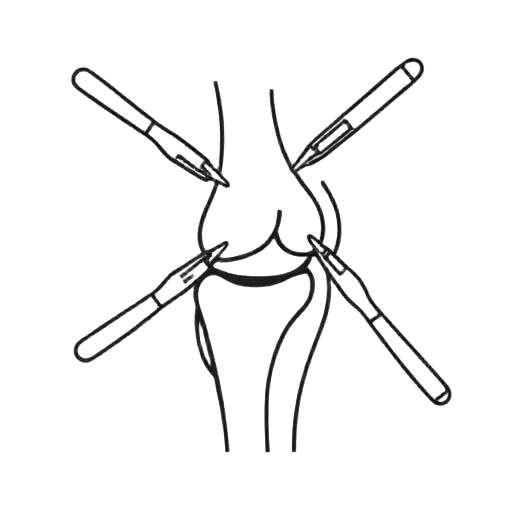 Cirurgia do Joelho